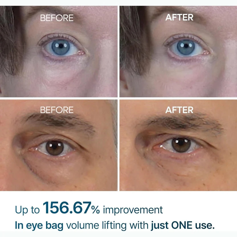 Dr. Melaxin Eyephalt Cream texture close-up