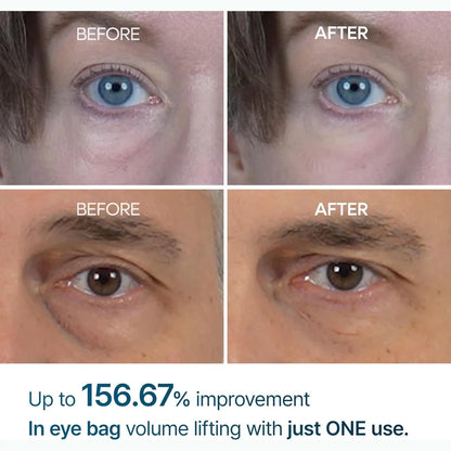 Dr. Melaxin Eyephalt Cream texture close-up