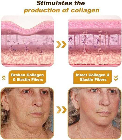 Botox Bee Venom Cream ingredients and benefits
