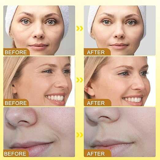 Botox Bee Venom Cream texture close-up